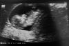 baby 002.jpg